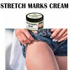 1x Scar Removal Cream For Surgical Scars Burns Stretch Marks Acne Spots Repair
