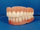 Dentures  Set Of False Teeth With Hollywood Bleach Shade Teeth