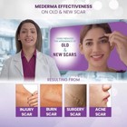 Mederma Advance Scar Gel   Acne   Surgery   Burn   Injury Removal Gel  10 Gm