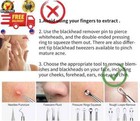 2024 Professional Pimple Popper Tool Kit - 22 Pcs Blackhead Remover Tools For Ac