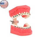 Dental Typodont Orthodontic Teeth Model With Brackets Brushing Flossing Practice