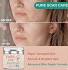 Scar Removal Cream - Rapid Repair Of New   Old Scars  Acne Spots  Burns  Surgery