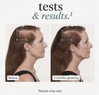 Womens Balance  1 Hair Growth   utr  f  l  Ages 40   Up  76  Off Amazon Retail  85