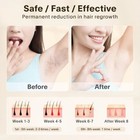 Ipl Laser Hair Removal Device Permanent Hair Remover For Women Men Face Body