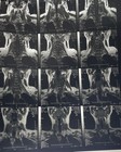 Vintage Anatomy X-ray Film  Used  Female Pelvis  Spine  Medical Photo Slide