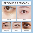 1-5pcs 15ml Firming Eye Serum For Reduces Under-eye Bags  Wrinkles  Dark Circles