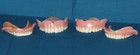 Two Sets Of Actual Dentures   False Teeth - Uppers And Lowers