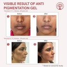 Natural Pig-mentation Gel   Fade Dark Spots   Restore Even Skin Tone  50 G 