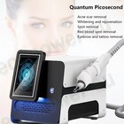 Laser Tattoo Spot Eyebrow Removal Machine Skin Face Whitening And Rejuvenating