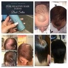 Nuskin Nu Skin Ageloc Nutriol Scalp   Hair System Kit-shampoo  Conditioner serum