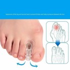 Corrector Hallux Valgus Bunion Toe Splint Straightener Big Foot Support Gel Pad