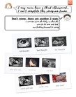 Triple Sonogram Pregnancy Frame     Baby Ultrasound Picture Frame With Story Fo   