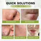 Blackhead Peel Off Face Mask  3-in-1 Blackhead Remover Mask With Brush   Tea    