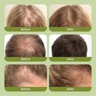 3pcs Organic Rosemary Hair Growth Shampoo For Natural Thickening   Strengthening