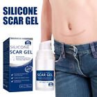 Advanced Scar Gel Effective For C-section  Stretch Marks  Acne  Surgery  2025