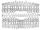  7 Upper Right Lateral Tooth - Dental Polycarbonate Temporary Crowns 6 Sizes 