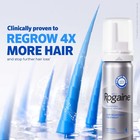 Men s Rogaine 5  Minoxidil Unscented Foam Hair Regrowth Treatment - Pack Of 3