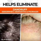 Medicasp Coal Tar Gel Dandruff Shampoo To Treat Seborrheic Dermatitis Psoriasis 
