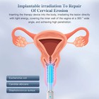 Vaginal Rejuvenation Red   Blue Light Therapy Device For Vaginitis  Ph Balance
