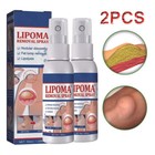 2pcs Lipomheilung Reduction Spray  Instant Lumpfree Lipoma Removal Spray Usa Hot