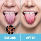 Tongue Scraper For Adults By Hokin  2pcs 2 Count  pack Of 1  U Shaped  Silver
