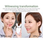 Sonic U-shaped Electric Toothbrush 360 Automatic Adults Teeth Whitening Care