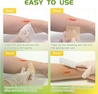 Manuka Honey Gauze Dressing 2 x2  Pack Of 10  Manuka Honey Wound Care Bandage F