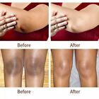 Kojic Acid Skin Whitening Lightening Brightening Serum Bleaching spot Fade Cream