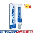 Scar Removal Cream Skin Repair Scar Remover Acne Treatment Fade  Stretch Mark