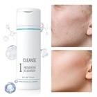 Proactiv 6oz Renewing Cleanser Day 60 Proactive Cleanse Solution