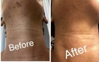 Dark Skin Bleaching Cream Whitening Lightening Dark Spot Max Strength Serum