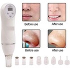 Digital Diamond 17 Dermabrasion Skin Peeling Beauty Device Facial Pores Cleaner