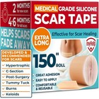 Medical Grade Silicone Scar Tape - 1 6   x150    - Visible Difference On Keloid     