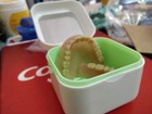 Custom-fit Upper And Lower Complete Denture  full Acrylic Set 