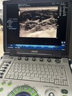 Ge Logiq E Ultrasound
