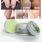9 X 60g D-lite Aloe Vera Cream Natural Organic Heel Rough cracked Dry Fingernail
