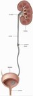 Double J  Stent With Pusher urology 6fr 26cm  50 Pieces  Dj Stent Free Shipping