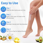 Urea Cream 40 Percent For Feet Maximum Strength  Foot Cream For Dry Cracked Heel