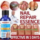 1-5pcs Finger Nail And Toe Nail Fungus Treatment Solution  Fungal Nail Repair Us
