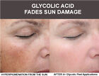 40  Glycolic Acid Spa Grade Pro Skin Peel 100  Pure Natural Wrinkles