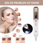 Electric Laser Plasma Mole Removal Pen Dark Spot Remover Skin Wart Tag Tattoo Us