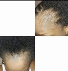Hair Growth Oil 2  Bottle   100ml