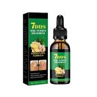 7 Days Nail Fungus Treatment All Natural Formula Gingers Nail Toenail Care 30ml
