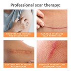 Professional Scar Therapy Gel   Old And New Scars From General Surgery  Traum   