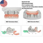 Us Dental Overdenture Implant Model All-on-4 With 4 Screw Upper lower Clear Jaw