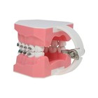 Us 1 1 Dental Orthodontic Teeth Model Typodont Demonstration Model With Brackets