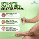 Miracle Foot Repair Cream  1 Oz  3 Pack  Foot Cream  Cracked Heel Cream