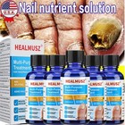 1 5pcs Finger Nail And Toe Nail Fungus Treatment Solution  Fungal Nail Repair