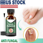 Anti Fungal Treatment Extra Strength Toenail Fungus Athletes Foot Fungi Nail  1