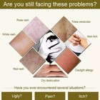 1 3 6 10 Pcs Skin Care Cream Natural Organic Herbal Skin Cream Healing Cream